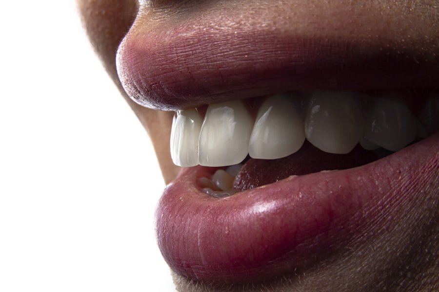 Gum treatment and scaling at Heerya Dental Hospital, Sangareddy