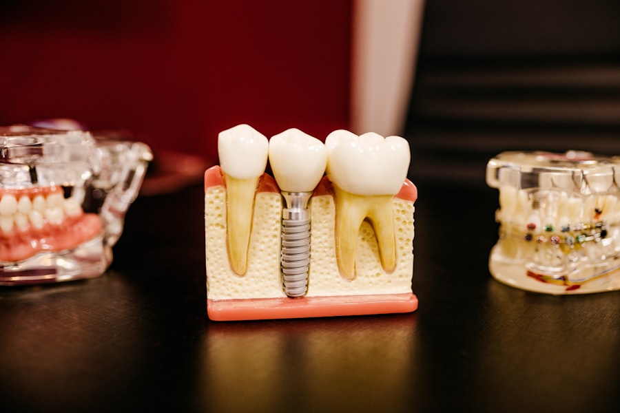 Dental crowns and bridges at Heerya Dental Hospital, Sangareddy